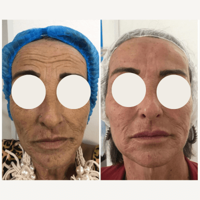 curso estética facial corporal (1)