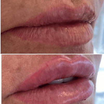 curso estética facial corporal (11)