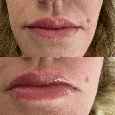 curso estética facial corporal (12)