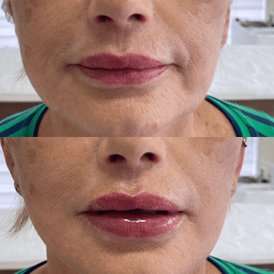 curso estética facial corporal (13)