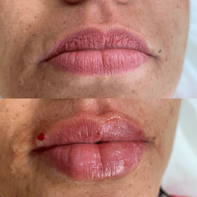 curso estética facial corporal (14)