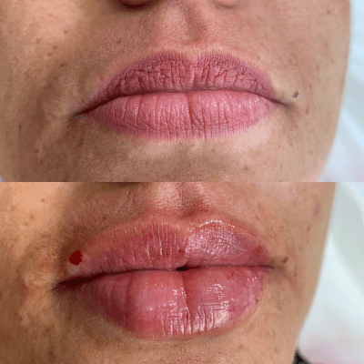 curso estética facial corporal (15)