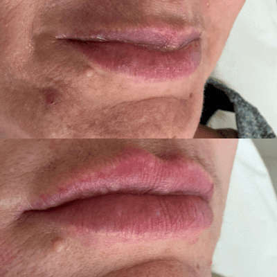 curso estética facial corporal (16)