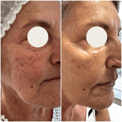 curso estética facial corporal (2)