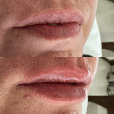 curso estética facial corporal (3)