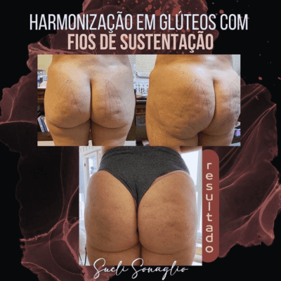 curso estética facial corporal (4)