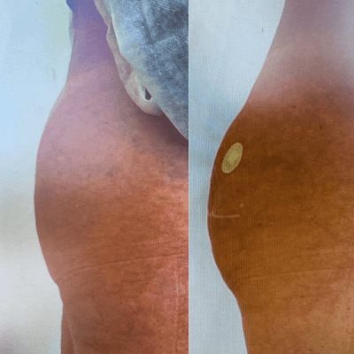 curso estética facial corporal (5)