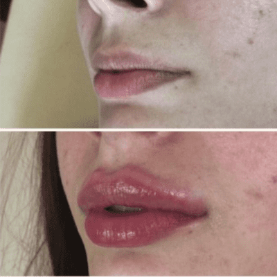 curso estética facial corporal (6)