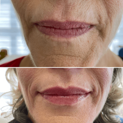 curso estética facial corporal (7)