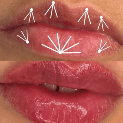 curso estética facial corporal (8)