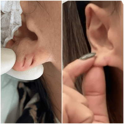 curso estética facial corporal (9)